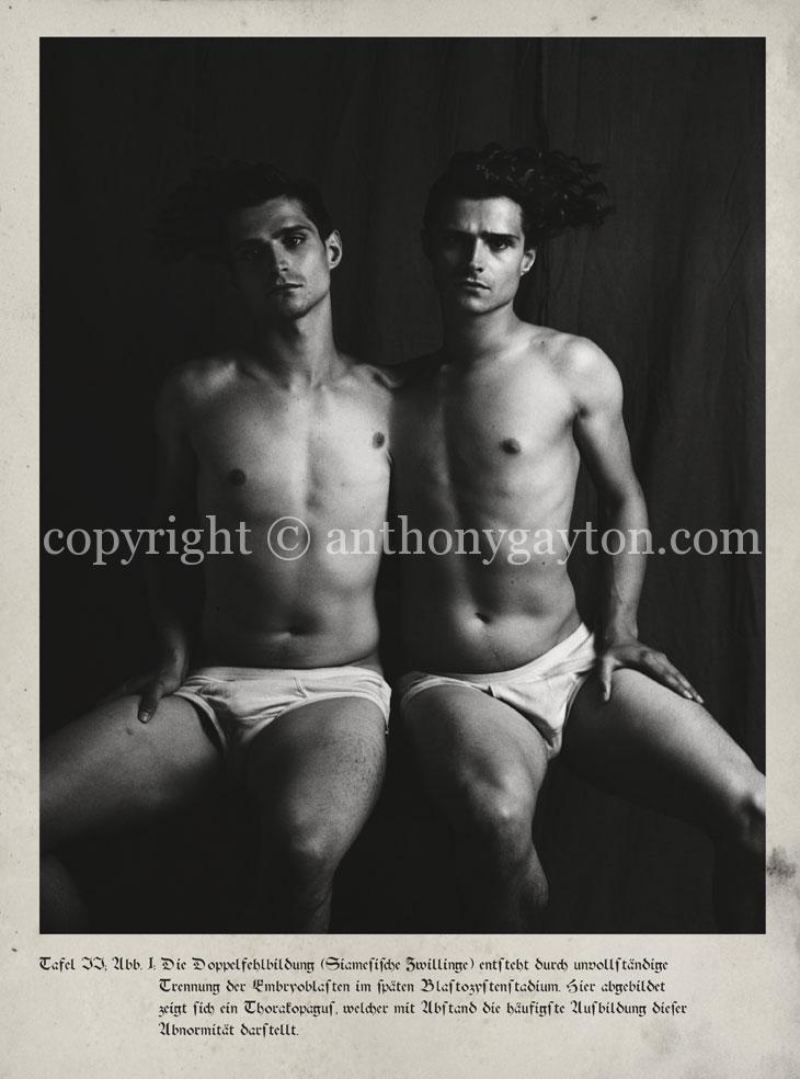 2_Doppelfehlbildung_Copyright_Anthony_Gayton